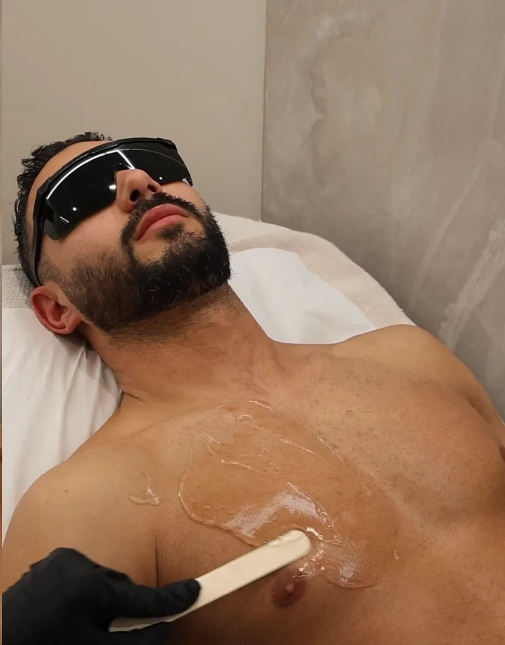 Épilation laser homme à Lille - Patient portant des lunettes de protection pendant la séance chez Oraskin